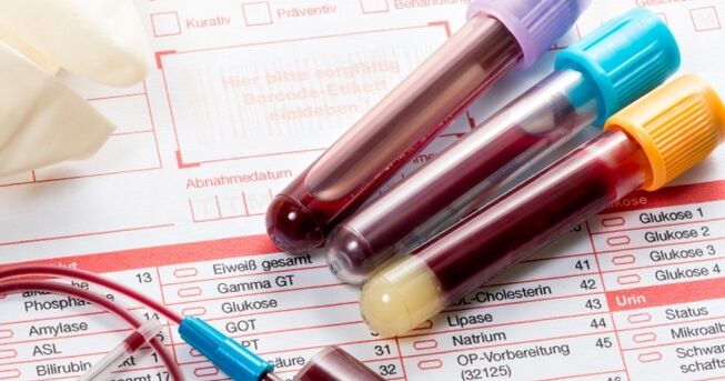 Xét nghiệm máu tìm vi rút u nhú ở người